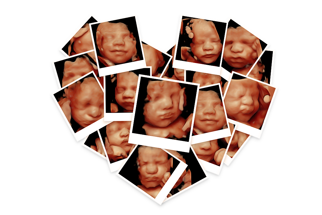 Baby Meets World 3D/4D HD Live Ultrasound Studio